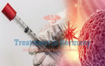 Blog Thumbnail Image