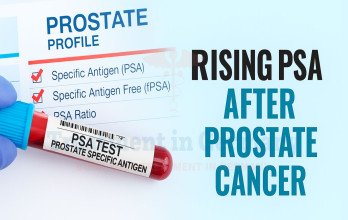 Blog Thumbnail Image