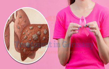 Blog Thumbnail Image