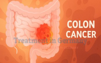 Blog Thumbnail Image