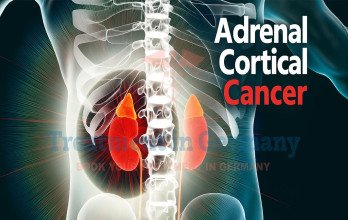 Blog Thumbnail Image