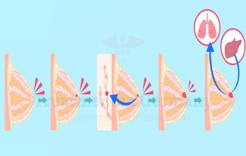 Blog Thumbnail Image